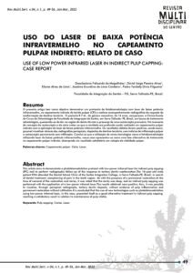 vol-4-n-1-a-8-USO-DO-LASER-DE-BAIXA-POTENCIA-INFRAVERMELHO-NO-CAPEAMENTO-PULPAR-INDIRETO_-RELATO-DE-CASO.pdf